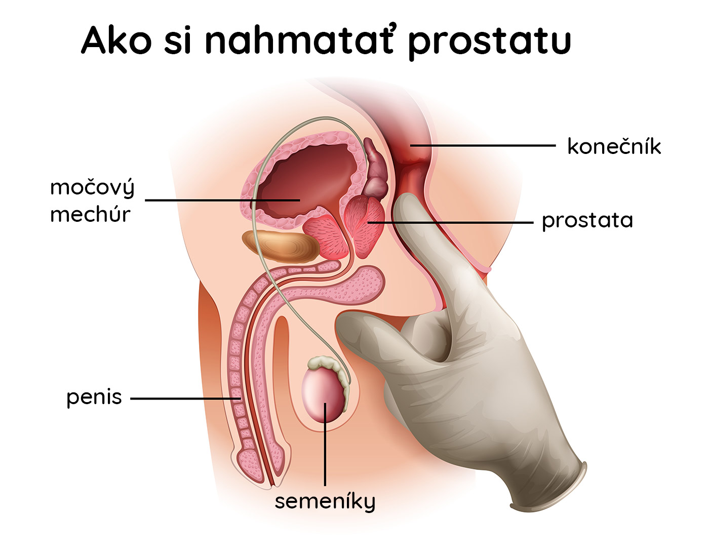 Ako nájsť prostatu